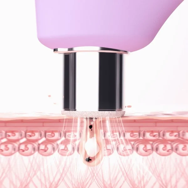 Gezichtsreinigingstools>FOREO Kiwi Derma Diamant Microdermabrasie & Porien Reinigingsapparaat